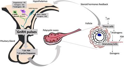 Polycystic Ovary Syndrome and Psychotic Disorder